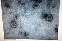 Viện vệ sinh dịch tễ Trung ương đã nuôi cấy và phân lập thành công virus corona mới. (Nguồn: Bộ Y tế)