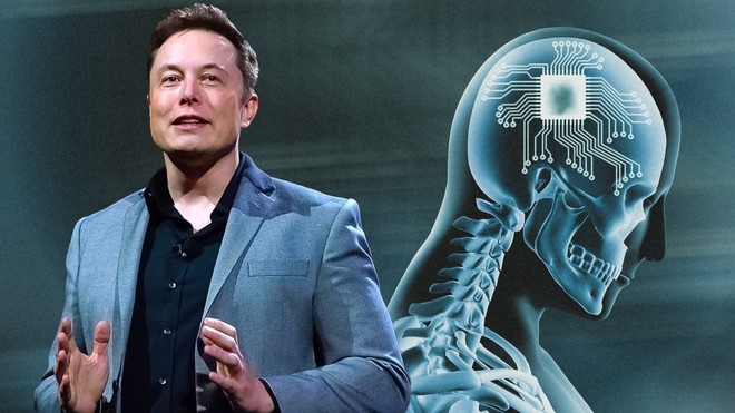 Vừa công bố thành tựu cấy chip lên não người, Elon Musk lập tức lấy lại vị trí giàu nhất thế giới