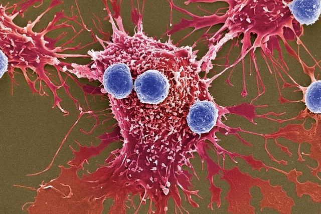 Nghiên cứu mới: Tiêu diệt ung thư bằng...“bom vi khuẩn“