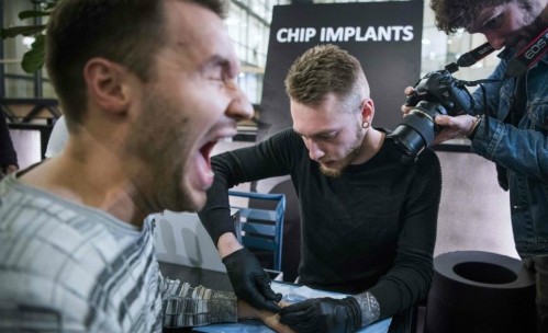 Một người đàn ông đang nhịn đau để cấy chip dưới da tay. Ảnh: AFP.