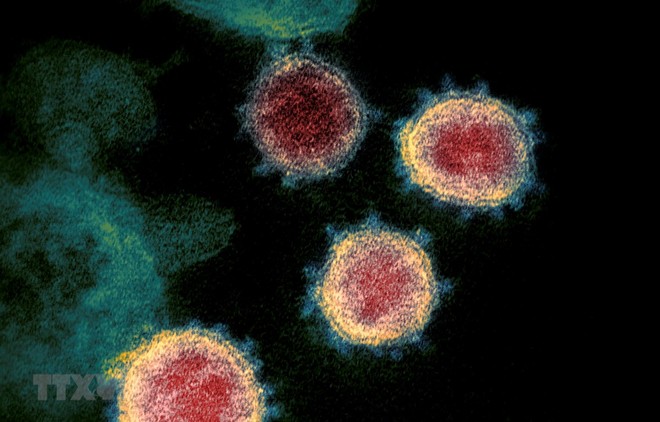Virus SARS-CoV-2 gây bệnh COVID-19 soi trên kính hiển vi. (Ảnh: AFP/ TTXVN).