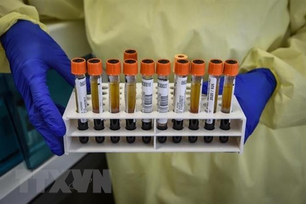 Các mẫu bệnh phẩm COVID-19 được sử dụng để nghiên cứu vắcxin phòng ngừa dịch tại bệnh viện Spallanzani ở Rome, Italy. (Nguồn: ANSA/TTXVN).