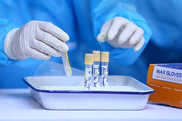 Mẫu được chuyển đến các trung tâm xét nghiệm bằng phương pháp RT-PCR. (Ảnh: Minh Quyết/TTXVN).