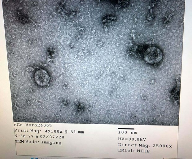 Viện vệ sinh dịch tễ Trung ương đã nuôi cấy và phân lập thành công virus corona mới. (Nguồn: Bộ Y tế)